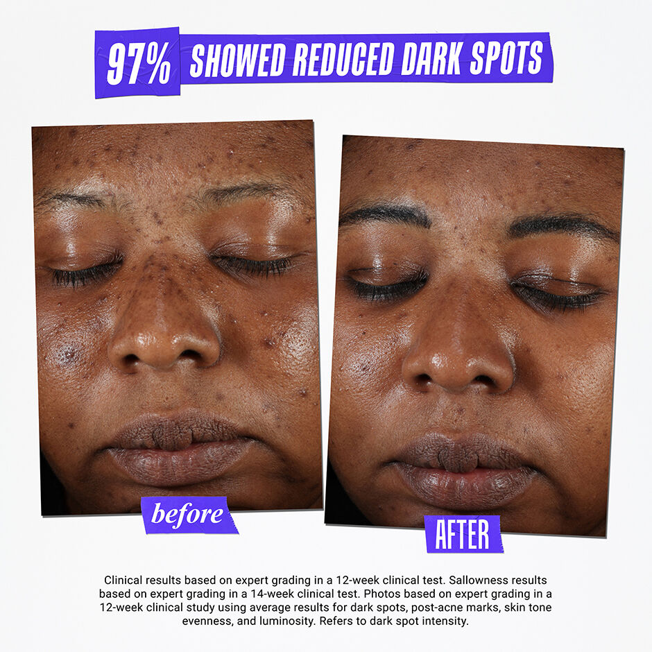 Kiehls dark online spot serum